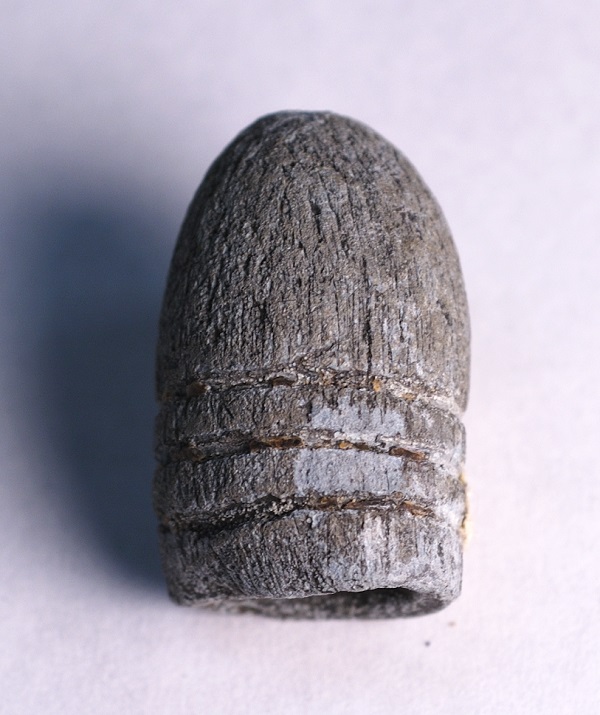 Image of bullet removed from Jefferson's body.